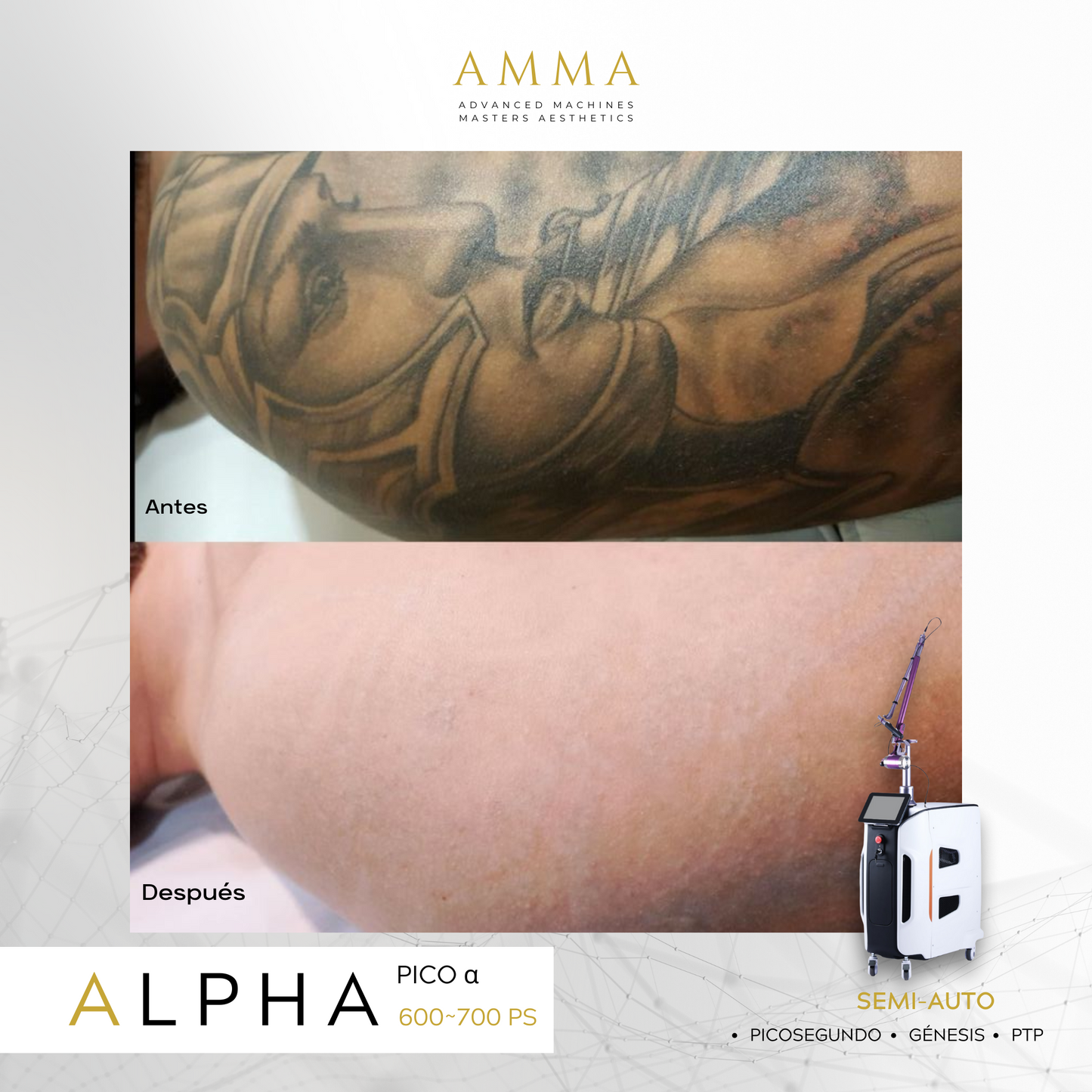 ALPHA 𝝰 · Láser PICOSEGUNDOS 𝐀𝐌𝐌𝐀 ⁶⁰⁰ᴾˢ ⁺🅟🅣🅟 · Eliminación de Micro / Tatuajes (2024)