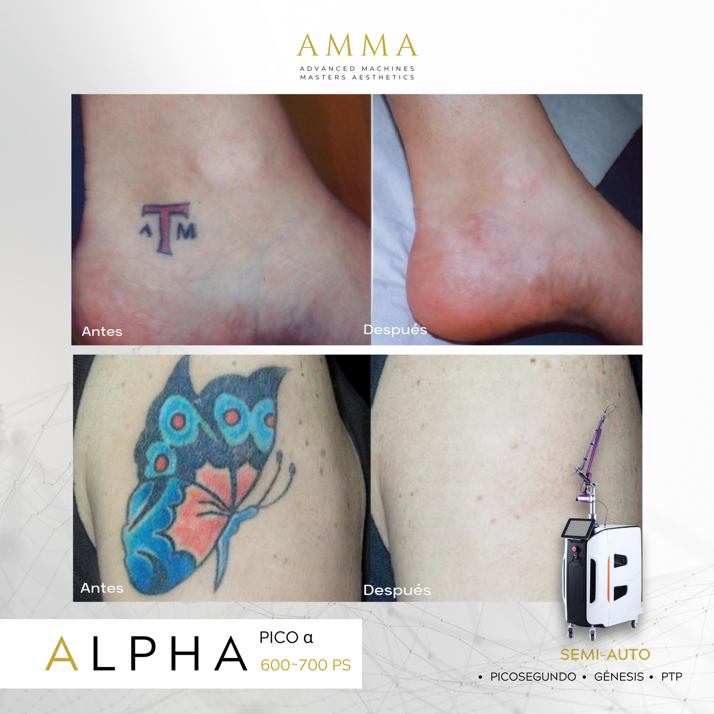 ALPHA 𝝰 · Láser PICOSEGUNDOS 𝐀𝐌𝐌𝐀 ⁶⁰⁰ᴾˢ ⁺🅟🅣🅟 · Eliminación de Micro / Tatuajes (2024)