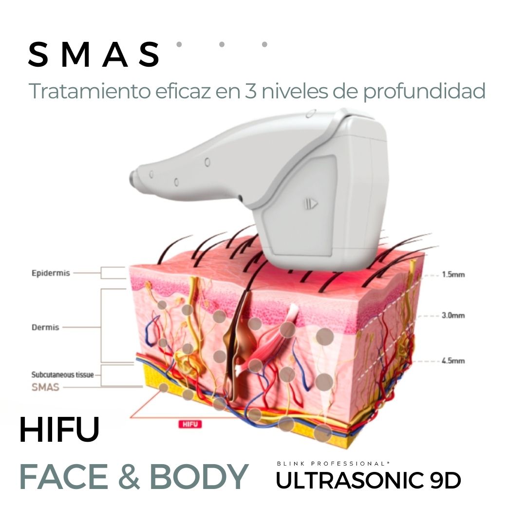 Ultrasonic 9D (Nuevo)