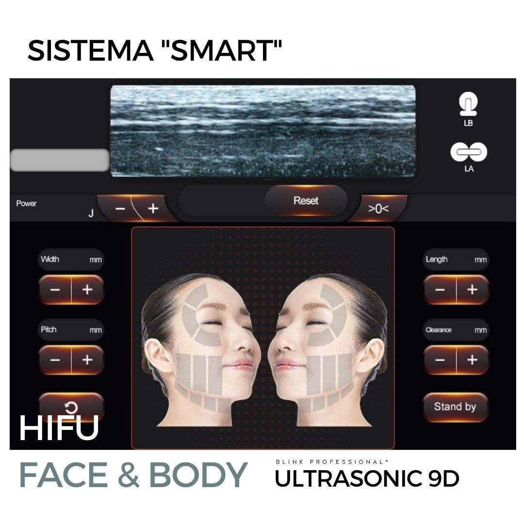 Ultrasonic 9D (Nuevo)